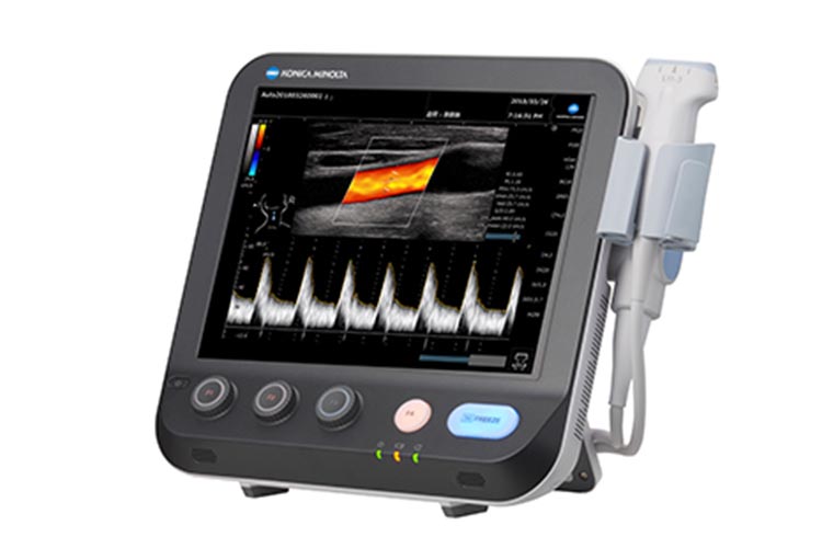 超音波診断装置(エコー検査)